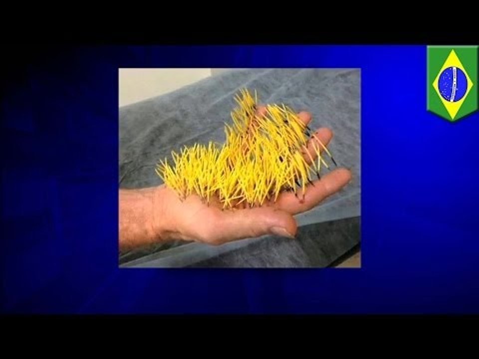 Hombre brasileño intenta espantar una "zarigüeya", termina con 400 púas de puerco espín