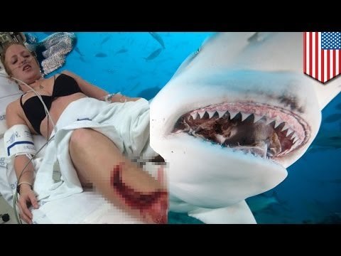 Mujer en Fort Lauderdale es atacada por un tiburón toro, sobrevive gracias a la ayuda de sus amigos