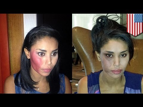 V. Stiviano, novia de Donald Sterling, es golpeada en un taxi en Nueva York, atacante arrestado