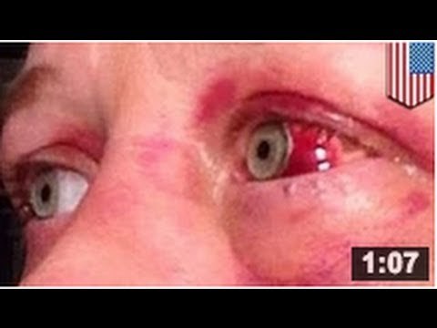 Violence conjugale: Une victime tient à rappeler à quoi ça ressemble