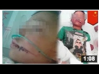 Une belle-mère abuse son beau-fils âgé de 6 ans et le laisse pour à moitié mort