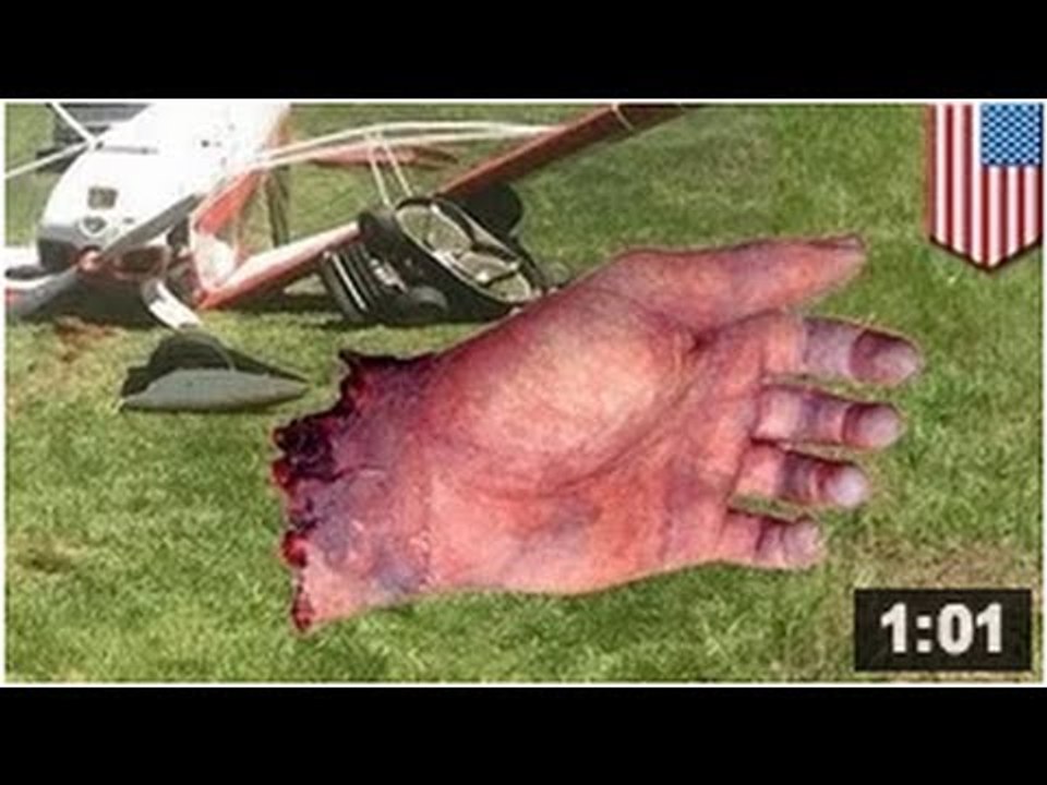 Ça fait 40 ans que John Rufty tond la pelouse, mais samedi dernier , il y a laissé une main.