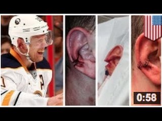 Christian Ehrhoff se fait arracher l'oreille... aïe aïe aïe...