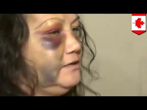 Canada police brutality: babae, binugbog ng pulis sa harap ng anak!