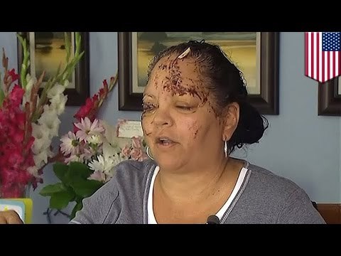 Lola, seryosong nasaktan matapos iligtas ang apo mula sa matapang na otter