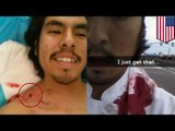 I got shot selfie: Mesa shooting victim snapchats his wounded shoulder BEFORE getting help