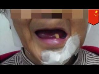 Worst China tour: Customer breaks jaw, loses teeth, guide orders her to keep shopping