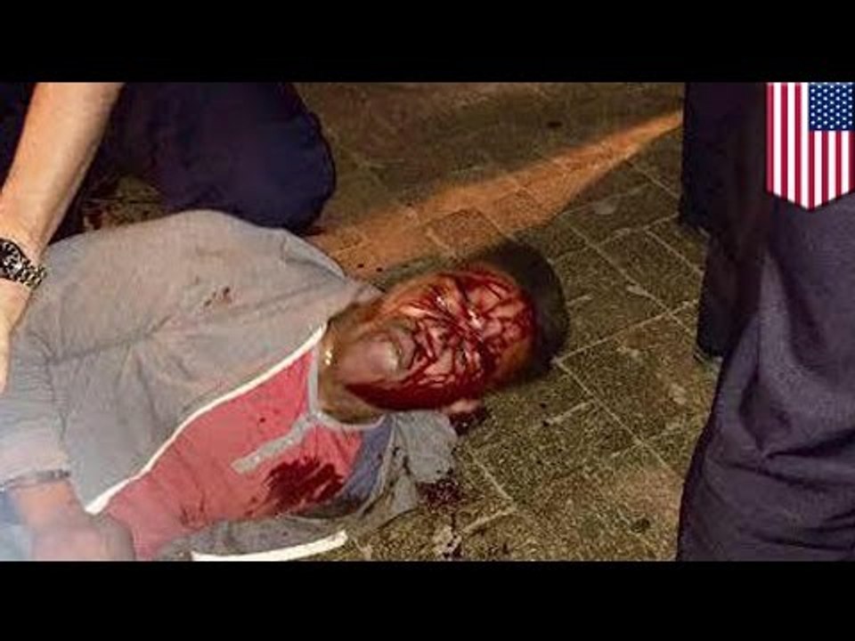 Police brutality caught on camera: Martese Johnson bloody arrest pix sparks outrage