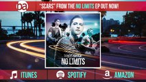 Boyce Avenue - Scars (Audio) on iTunes & Spotify