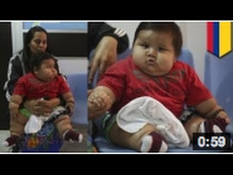 Un bébé de 8 mois pese la bagatelle de 20 kg