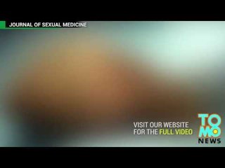 17-latek przechodzi pierwszą na świecie operację pomniejszenia penisa