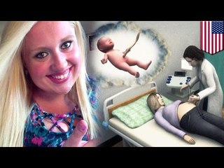 Surprise pregnancy: Woman didn’t know she was pregnant until she was giving birth