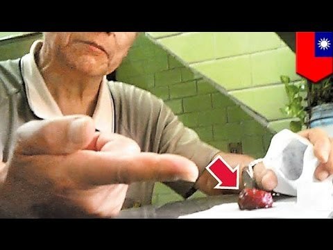 Doktor sa Taiwan, nagbebenta ng donor blood, para gawing pekeng virgin blood ng mga prostitutes!