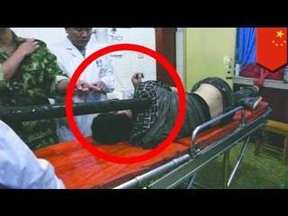 Lalaki, nahulog nang 50 feet sa poste ng ilaw na tumagos sa kanyang katawan - at siya ay naligtas!