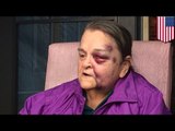 Grandma foils teen carjackers: Elderly woman pistol-whipped while fighting car thieves