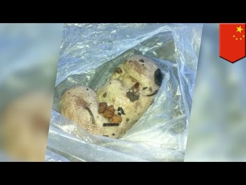 Medical Horror Story:A woman gives birth to a piece of gauze after only giving birth to her daughter