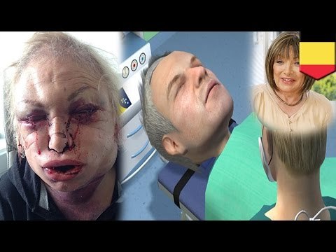 Plastic surgery dangers, former boxing promoter Kellie Maloney almost dies after facial procedure