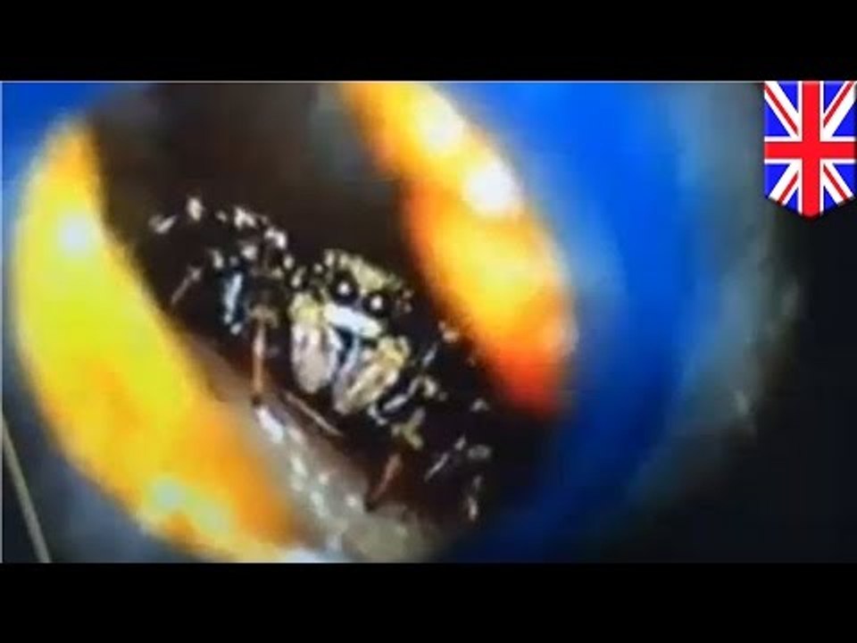Spider in ear: Katie Melua discovers sounds inside her head caused by a tiny spider