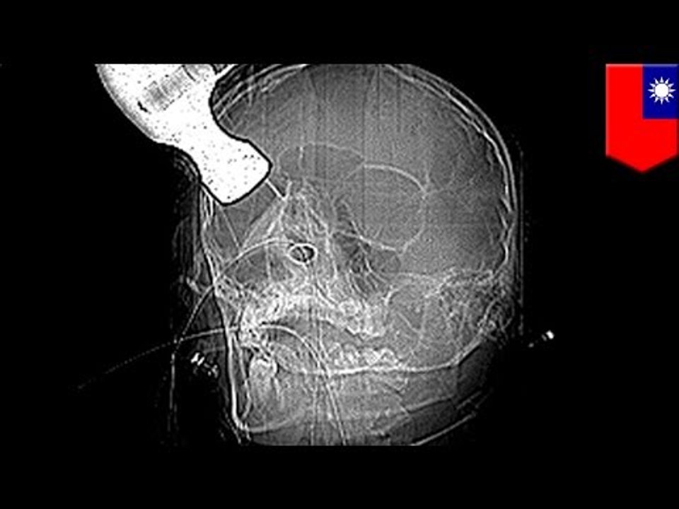 Attempted hammer murder: Security guard tries to bash in accountant’s head