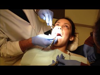 Tooth Extractions with Dr. Devore