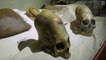 Les plus grands crânes allongés du monde ? Musée d'Ica, Pérou, par Brien Foerster (VOSTFR)