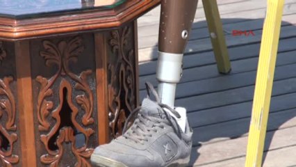 Antalya Sanayide Yaptırdığı Protez Ayakla Dağları Aşacak