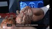 euronews science - Le cerveau s'attrophie en cas de dépression majeure