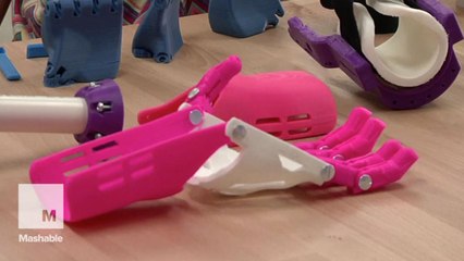 7-year-old girl gets 3-D printed 'robohand'