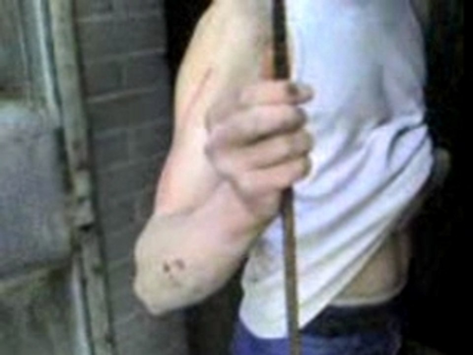 aie aie aie ca fais mal