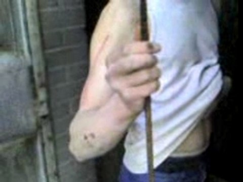 aie aie aie ca fais mal