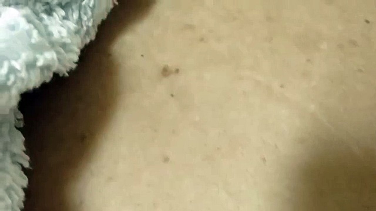 blackhead popping 03