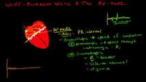 Pathophysiology of Wolff-Parkinson White Syndrome