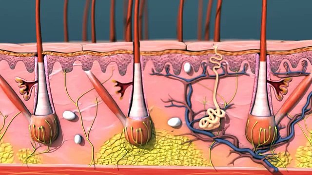 Blackheads vs. Whiteheads
