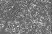 Differentiation of MM14 skeletal muscle cells.