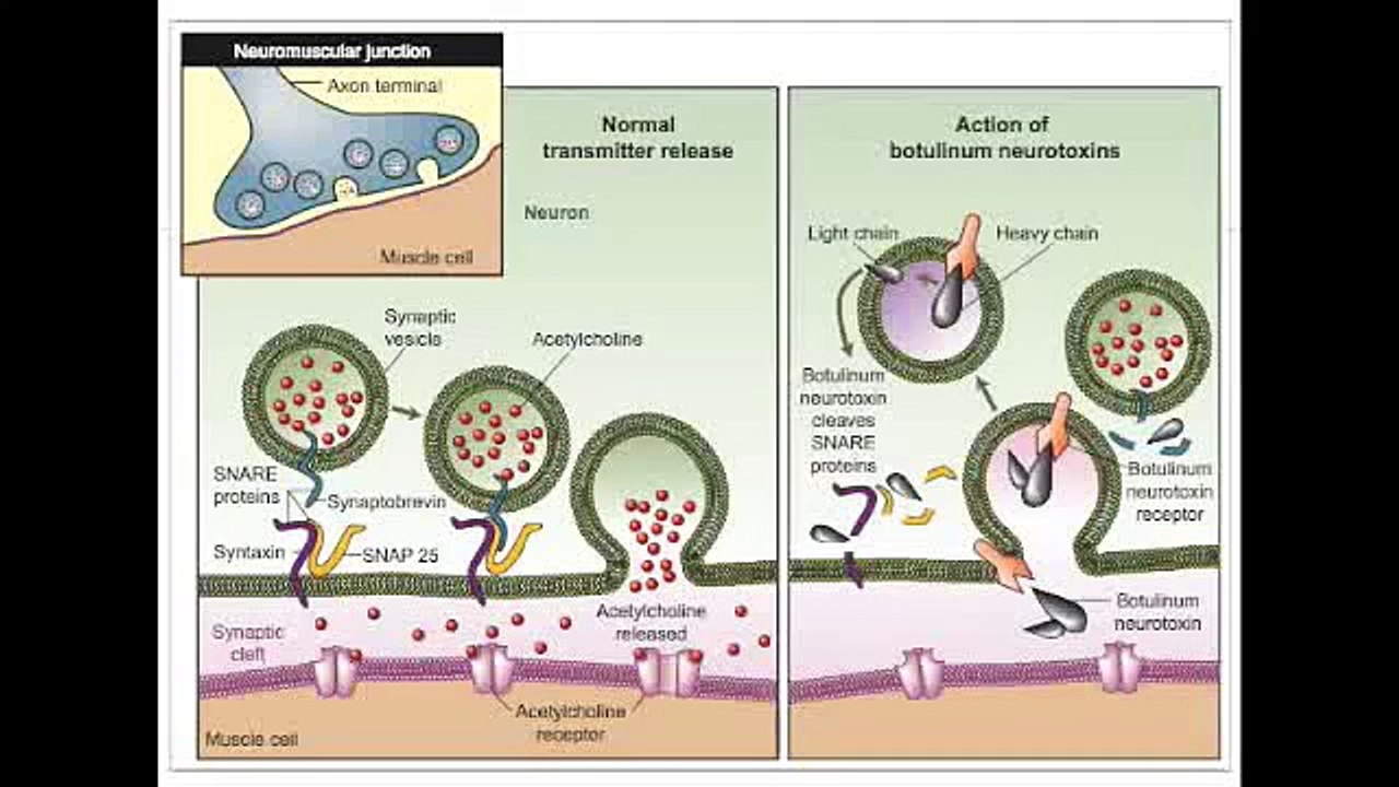 Botulinum + Tetanus Toxin Mechanism