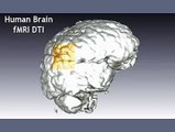 Human Brain Magnetic Resonance / Diffusion Tensor Imaging