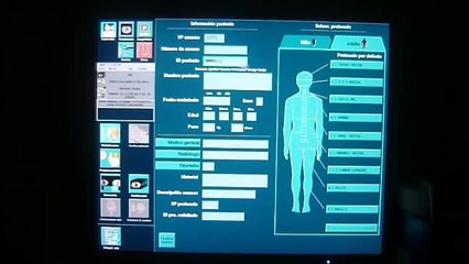 Tomografía. TAC cerebral