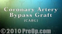 Coronary Artery Bypass Graft (CABG) Surgery PreOp® Patient Education Feature