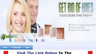 Get Rid Of Hives Get Discount Bonus + Discount