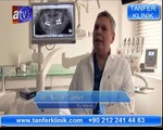 İmplant tedavisi sağlığımızı etkiler mi ?Tanfer Klinik