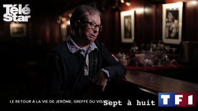 7 à 8 - Les confessions de Jérôme Hamon, entièrement greffé du visage - Dimanche 19 avril 2015