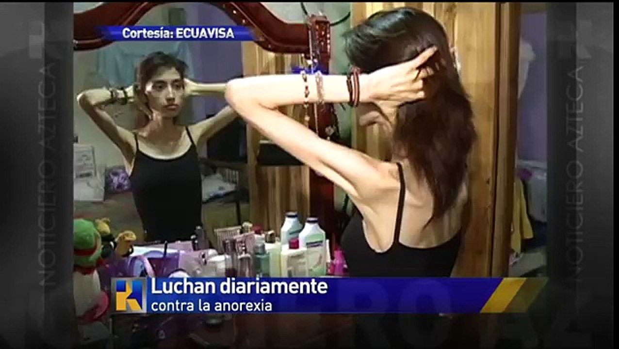 Un caso de anorexia en Ecuador