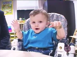 Cochlear Implant before surgery