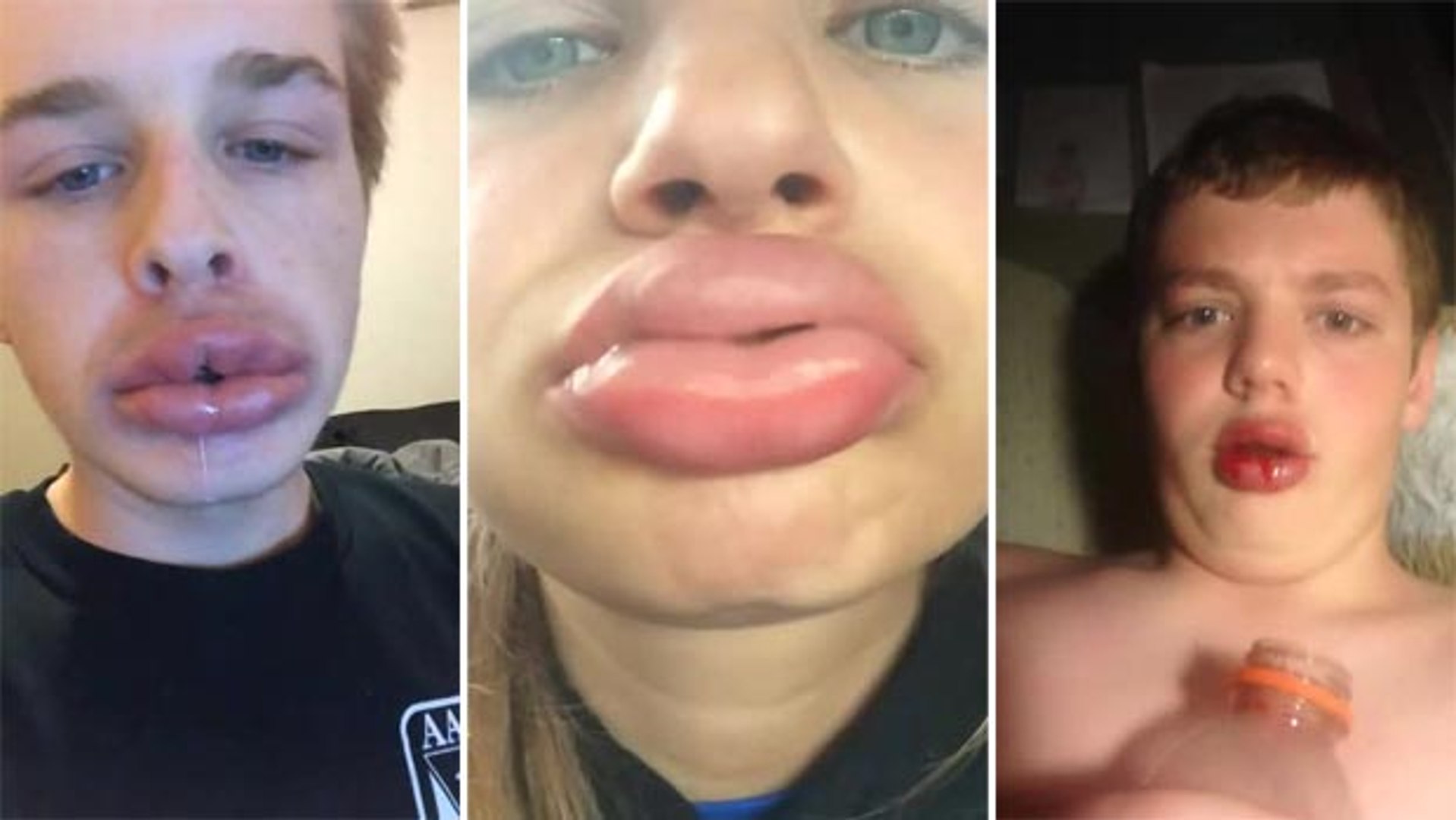 Comment avoir des lèvres pulpeuses en quelques secondes ?  #kyliejennerchallenge - Vidéo Dailymotion