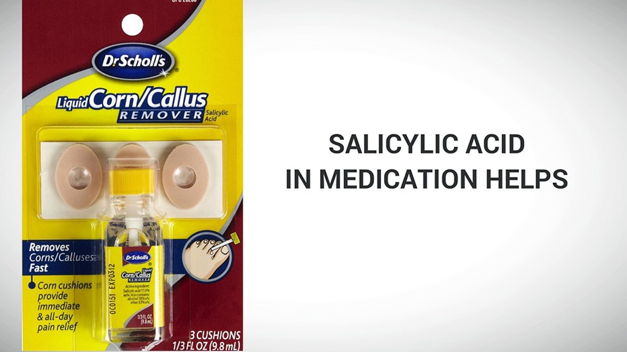 Corn And Callus Remover Home Remedies For Foot Care