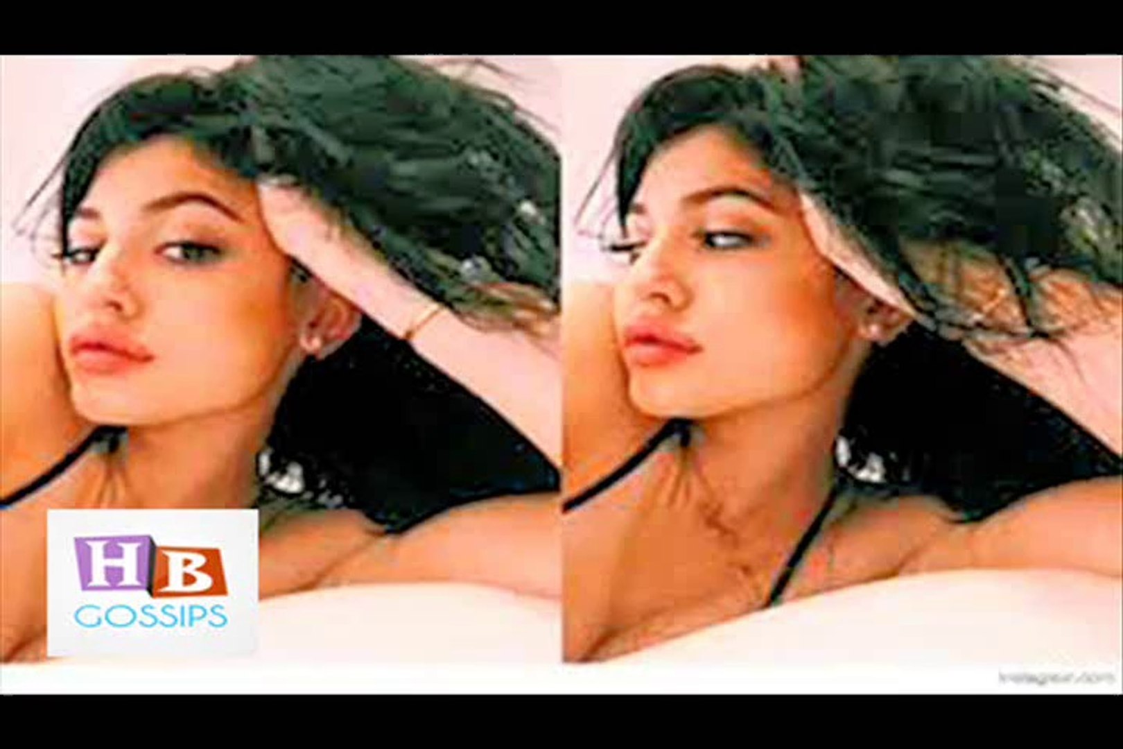 ⁣Kylie Jenner Weird Duck Lips 2015