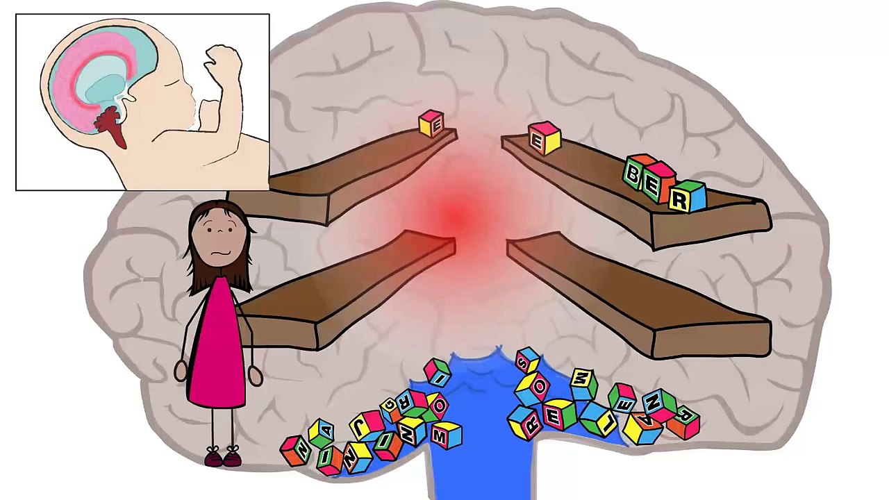 Hydrocephalus - Get inside my head