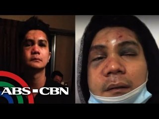 Shocking Photos of Vhong Navarro after The Fort attack