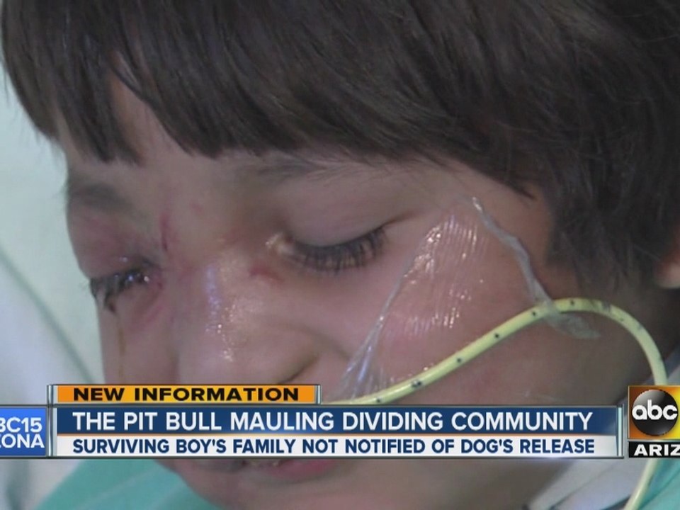 Pit bull mauling dividing the community