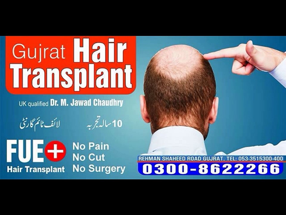 The worlds best hair transplant surgery by FUE method in pakistan.
